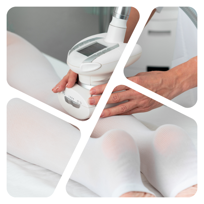 Kozmetički aparati za tretmane tela